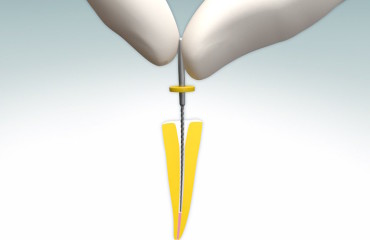 ENDODONZIA